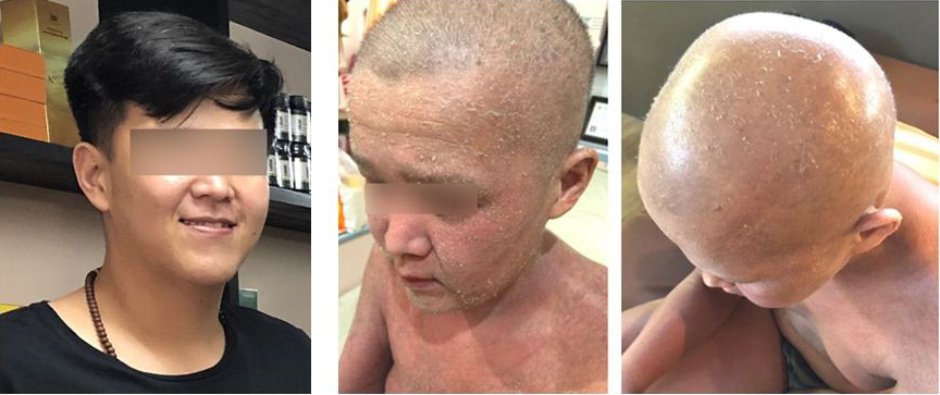 a First sign of problem.JPG