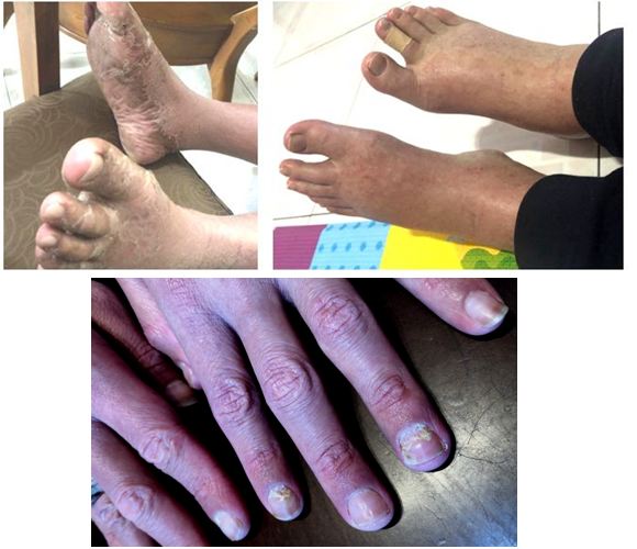 b Composite Bald No caption.jpg