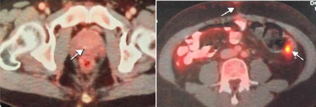 14 June 2019 composite.JPG