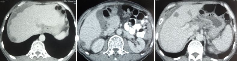 Wongso composite.JPG